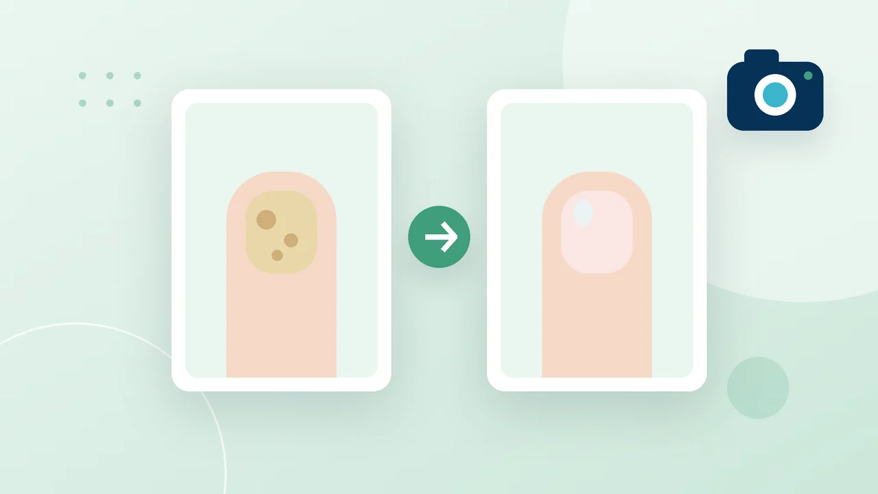 Before-and-after photos: how to show progress honestly